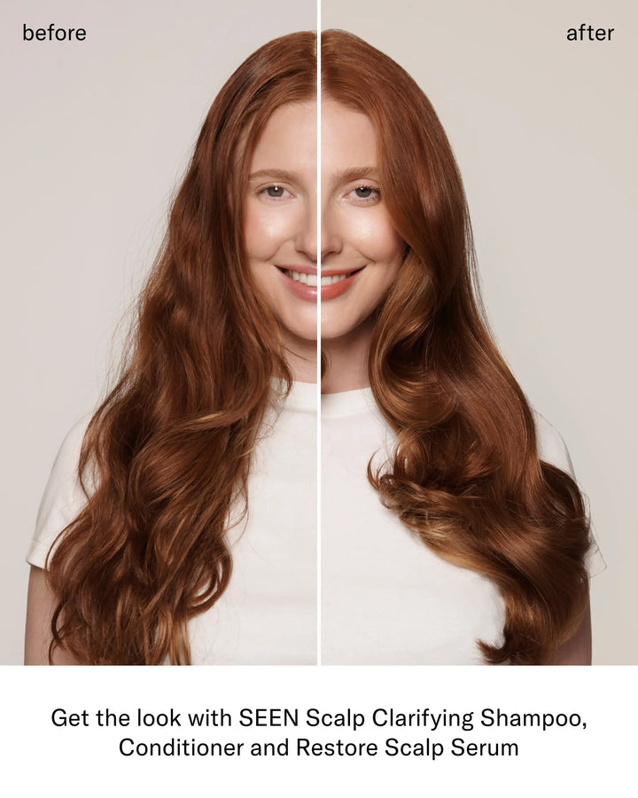 SEEN Healthy Scalp Bundle